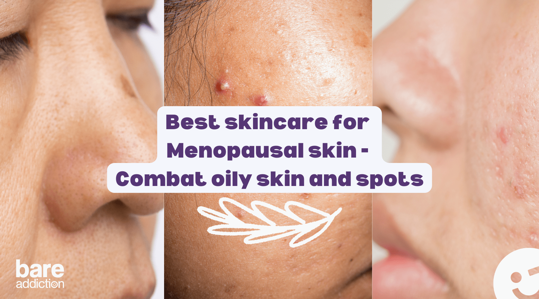 Best skincare for  Menopausal skin -  Combat oily skin and spots - three pictures of mature age skin showing signs of oily and spotty skin