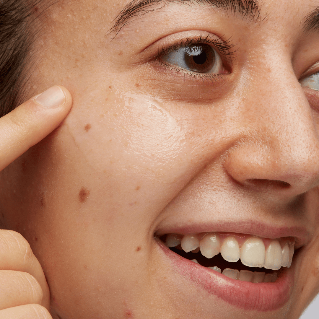 Anti-blemish Boost Serum 30ml